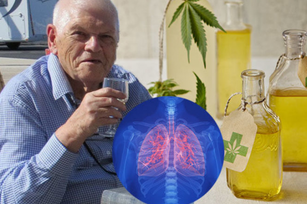 The Benefits of CBD Oil for Lung Cancer