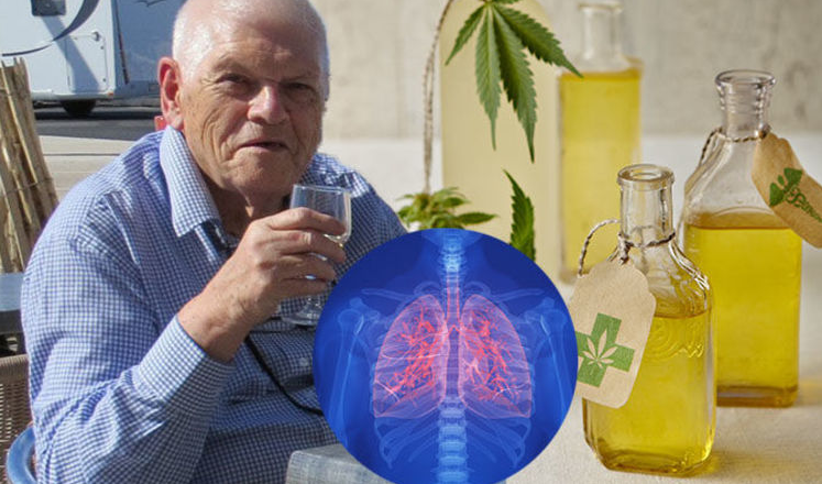 The Benefits of CBD Oil for Lung Cancer