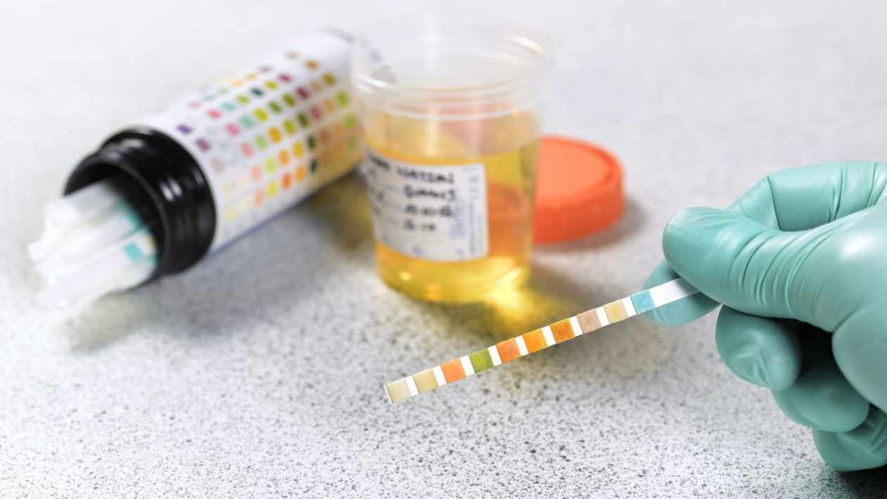 Medications Can Result in False Positive Urine Drug Test